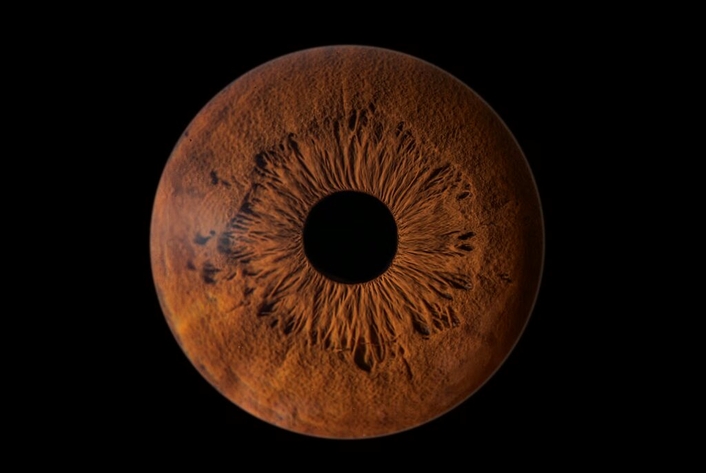 1 Iris