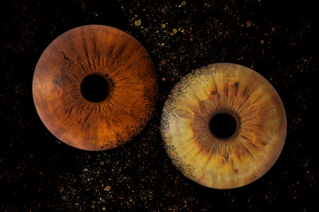 2 Iris