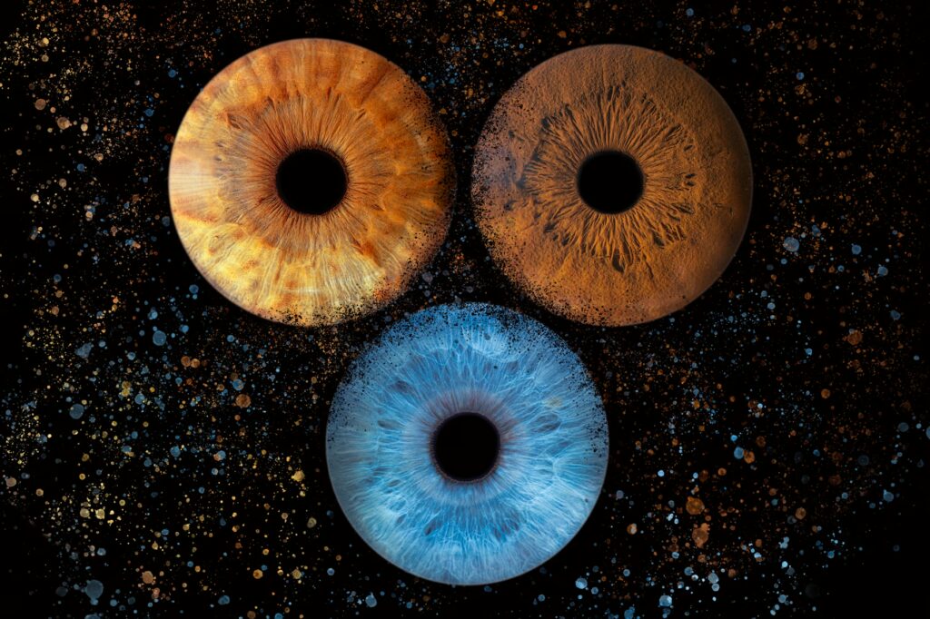 3 Iris